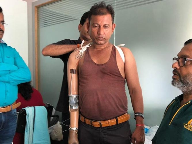 Fitment of Free artificial limbs and calipers
